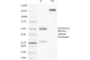 SDS-PAGE Analysis Purified CD21-Monospecific Mouse Monoclonal Antibody (CR2/3247). (CD21 anticorps  (AA 142-240))