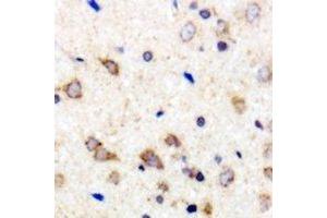 Immunohistochemical analysis of 42431 staining in human brain formalin fixed paraffin embedded tissue section. (MARCH2 anticorps  (C-Term))