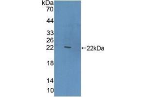 Western blot analysis of recombinant Human CLEC10A. (CLEC10A anticorps  (AA 71-239))