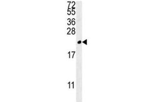 TREM2 antibody western blot analysis in MDA-MB435 lysate.