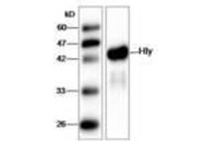 anti-Listeria Monocytogenes Hly (AA 20-119) antibody
