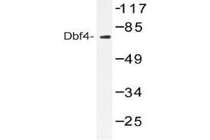 Western blot (WB) analysis of Dbf4 antibody in extracts from NIH-3T3 treated with H2O2 100uM 30'. (DBF4 anticorps)