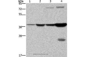 Western blot analysis of Mouse stomach and human fetal liver tissue, MCF-7 cell and mouse liver tissue, using FBP1 Polyclonal Antibody at dilution of 1:550 (FBP1 anticorps)