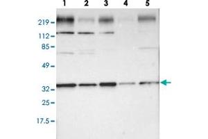 Western blot analysis of lane 1: RT-4, lane 2: U-251 MG, lane 3: A-431, lane 4: Liver and lane 5: Tonsil using STX4 polyclonal antibody . (Syntaxin 4 anticorps)