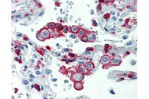 Anti-ITGB2 / CD18 antibody IHC staining of human lung. (Integrin beta 2 anticorps  (AA 534-546))