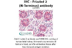 Image no. 1 for anti-Frizzled Family Receptor 2 (FZD2) (Extracellular Domain), (N-Term) antibody (ABIN1734468) (FZD2 anticorps  (Extracellular Domain, N-Term))