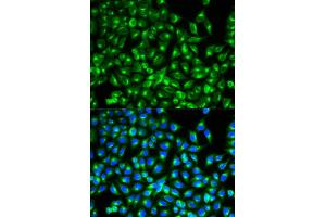 Immunofluorescence (IF) image for anti-Cell Division Cycle 34 (CDC34) antibody (ABIN1876645) (CDC34 anticorps)