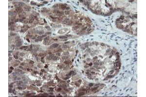 Image no. 1 for anti-PYD and CARD Domain Containing (PYCARD) antibody (ABIN1500518)