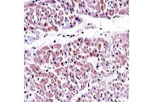 PTEN antibody immunohistochemistry analysis in formalin fixed and paraffin embedded human heart tissue.