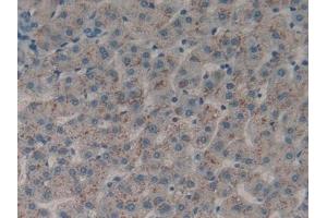 Detection of DDR1 in Human Liver Tissue using Polyclonal Antibody to Discoidin Domain Receptor Family, Member 1 (DDR1)