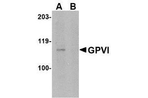 Image no. 1 for anti-Glycoprotein VI (Platelet) (GP6) (Internal Region) antibody (ABIN342706) (GP6 anticorps  (Internal Region))