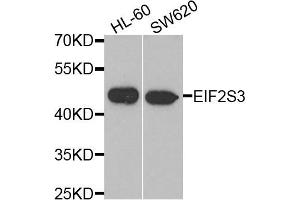 Western blot analysis of extracts of HL60 and SW620 cell lines, using EIF2S3 antibody. (EIF2S3 anticorps)