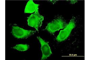 Immunofluorescence of monoclonal antibody to PIP5K3 on HeLa cell.