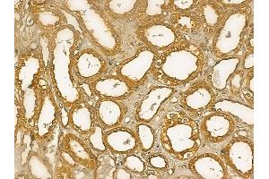 GMPPB Mouse Monoclonal Antibody at 1/100 staining human normal kidney tissue by IHC-P. (GMPPB anticorps)
