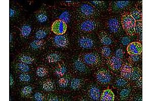 Immunofluorescence staining of FYN in human HeLa cell line using FYN monoclonal antibody, clone FYN - 01 (Cat # MAB0947 ; green) .