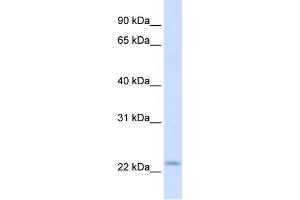 WB Suggested Anti-REEP1 Antibody Titration:  0. (Receptor Accessory Protein 1 anticorps  (C-Term))