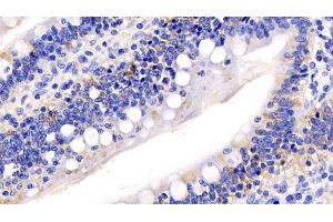 Detection of CYCS in Human Small intestine Tissue using Monoclonal Antibody to Cytochrome C (CYCS) (Cytochrome C anticorps  (AA 5-100))