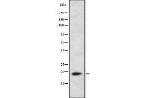 Western blot analysis of MYL2 using LOVO whole  lysates. (MYL2 anticorps  (N-Term))