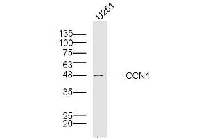 U251 lysates probed with Cry61 Polyclonal Antibody, Unconjugated  at 1:300 overnight at 4˚C. (CYR61 anticorps  (AA 251-379))