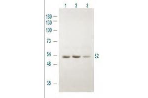Western blot using Rockland's Affinity Purified anti-GSK3A antibody shows detection of a 52 kDa band corresponding to human GSK3A in various human derived 293T cell extracts. (GSK3 alpha anticorps  (pSer21))