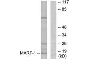 Western blot analysis of extracts from NIH-3T3 cells, using MART-1 Antibody. (MLANA anticorps  (AA 41-90))