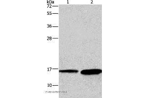 Western blot analysis of Mouse heart and human hepatocellular carcinoma tissue, using HINT2 Polyclonal Antibody at dilution of 1:300 (HINT2 anticorps)