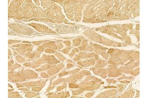 ABIN6257336 and ABIN6275089 at 1/100 staining human tongue carcinoma by IHC-P. (MYLIP anticorps  (Internal Region))
