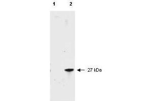 Western Blotting (WB) image for anti-Red Fluorescent Protein (RFP) antibody (ABIN129578)