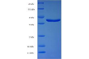 SDS-PAGE (SDS) image for RAB11A, Member RAS Oncogene Family (RAB11A) (AA 2-213) protein (His-SUMO Tag) (ABIN5710201)