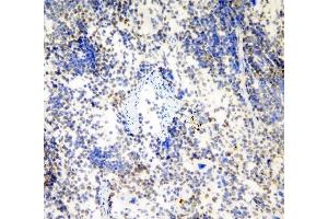 IHC analysis of HP1 gamma using anti-HP1 gamma antibody (ABIN5693033). (CBX3 anticorps  (AA 2-183))