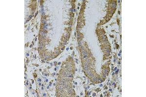 Immunohistochemistry of paraffin-embedded human stomach using MTIF3 antibody. (MTIF3 anticorps  (AA 1-278))