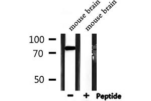 Western blot analysis of extracts from mouse brain, using ATF6B Antibody. (ATF6B anticorps  (Internal Region))