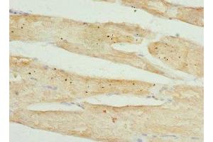 Immunohistochemistry of paraffin-embedded human skeletal muscle tissue using ABIN7173557 at dilution of 1:100 (Tropomodulin 4 anticorps  (AA 1-345))