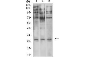 Western blot analysis using ELANE mouse mAb against U937 (1), SPC-A-1 (2), and COS7 (3) cell lysate.