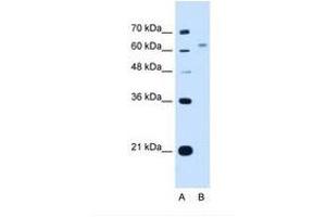 Image no. 1 for anti-WSC Domain Containing 2 (WSCD2) (C-Term) antibody (ABIN341313) (WSCD2 anticorps  (C-Term))