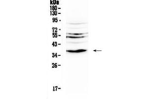 Western blot analysis of IL12B using anti-IL12B antibody .