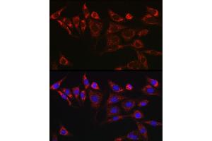 Immunofluorescence analysis of NIH/3T3 cells using KITLG Rabbit pAb (ABIN6128159, ABIN6142901, ABIN6142902 and ABIN6221323) at dilution of 1:25 (40x lens). (KIT Ligand anticorps  (AA 26-214))