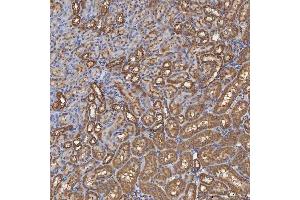 IHC analysis of SEC31A using anti-SEC31A antibody (ABIN7599630).