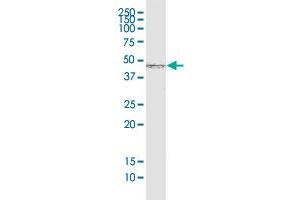 SMAD7 monoclonal antibody (M05), clone 2G6. (SMAD7 anticorps  (AA 160-260))