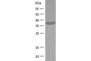 Western Blotting (WB) image for Guanine Nucleotide Binding Protein (G Protein), alpha Inhibiting Activity Polypeptide 2 (GNAI2) (AA 1-355) protein (His tag) (ABIN7123238) (GNAI2 Protein (AA 1-355) (His tag))