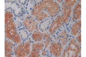 Detection of CD26 in Human Kidney Tissue using Polyclonal Antibody to Cluster Of Differentiation 26 (CD26)