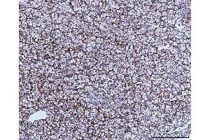 IHC analysis of GLUD1/2 using anti-GLUD1/2 antibody (ABIN7602000). (GLUD1 / GLUD2 (AA 54-553) anticorps)