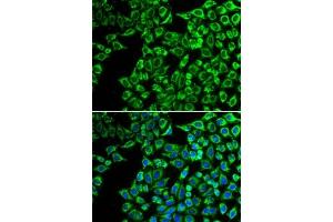 Immunofluorescence analysis of  cells using LIPC antibody (ABIN6131783, ABIN6143250, ABIN6143251 and ABIN6217533). (LIPC anticorps  (AA 280-499))