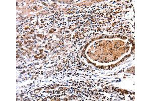 Immunohistochemistry (IHC) image for anti-DNA (Cytosine-5-)-Methyltransferase 3 alpha (DNMT3A) antibody (ABIN1872325) (DNMT3A anticorps)