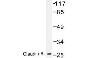 Image no. 2 for anti-Claudin 6 (CLDN6) antibody (ABIN317829) (Claudin 6 anticorps)