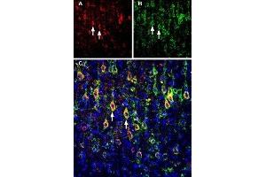 Multiplex staining of Slitrk1 and KV2. (SLIT and NTRK-Like Family, Member 1 (SLITRK1) Peptide)