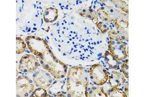 Immunohistochemistry of paraffin-embedded Mouse kidney using COMT Polyclonal Antibody at dilution of 1:100 (40x lens). (COMT anticorps)