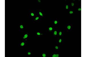 Immunofluorescence staining of Hela cells (treated with 30mM sodium butyrate for 4h) with ABIN7139203 at 1:5, counter-stained with DAPI.