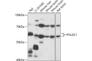 Western blot analysis of extracts of various cell lines, using PNLDC1 antibody (ABIN7269447) at 1:1000 dilution.