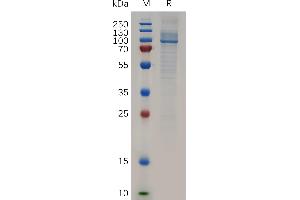 Human AA1 Protein, N-His Tag on SDS-PAGE under reducing condition.